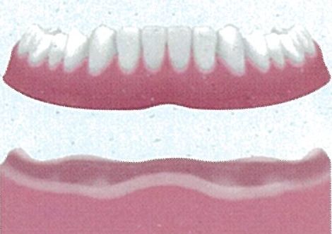 歯が全くない場合 従来